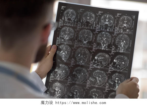 办公室里男医生看脑X光射线图像